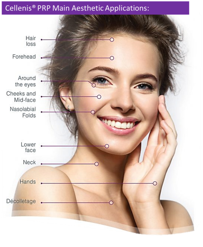 Cellenis PRP Main Application Areas